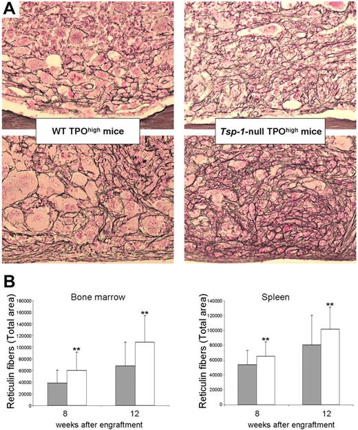 Figure 2. Increased BM and spleen fibrosis in Tsp-1–null TPOhigh mice. (A) Representative histologic sections of femurs (top panels) and spleen (bottom panels) from WT TPOhigh mice or Tsp-1–null TPOhigh mice at week 12 after engraftment. Silver staining reveals BM and spleen fibrosis in both TPOhigh groups of mice. Images were obtained using a Leica DMRB microscope (total original magnification ×250) 25×/0.85 NA objective and acquired with a Video 3 charge-coupled device Sony Leica Power hole accumulated diode camera. (B) An increased fibrosis was observed in both BM and spleen from Tsp-1–null TPOhigh mice (□) compared with WT TPOhigh mice () at weeks 8 or 12 after engraftment. Total area of reticulin fibers was quantified using ImageJ software. Results of statistical analysis with the Wilcoxon test are as follows: WT TPOhigh mice versus Tsp-1–null TPOhigh mice: **P < .001.
