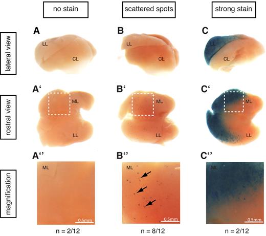 Figure 5. CNC12 activates transcription in the mouse E14.5 liver. Twelve embryos resulting from Hsp68CNC12 LacZ transgenesis showed blue staining in the liver or other structures, indicating successful transgene integration. The livers of these 12 embryos were dissected and pictures from lateral (a-c) and rostral (a'-c') views were taken for each of them (1 representative liver is shown per group; see supplemental Figure 2 for the complete set). As shown in panel a-a″, b-b″, and c-c″, 3 groups could be detected within the 12 transgenics embryos: (a-a″) embryos with no lacZ transcriptional activation in the liver (n = 2), (b-b″) embryos with scattered blue spots specifically in the liver (n = 8), and (c-c″) embryos exhibiting a strong staining in the median and left lobes of the liver (n = 2). Panel a″-c″ are magnifications of the median lobe of each of the representative livers (white boxed region in each of the liver from a'-c' panel). LL: left lobe, CL: caudate lobe, ML: median lobe.