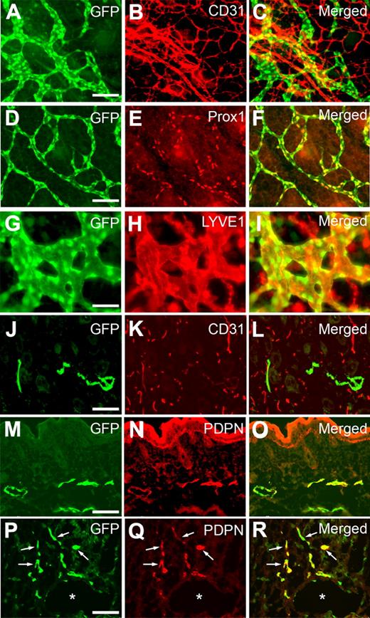 Figure 2. Colocalization of the GFP signal with various lymphatic markers throughout development. Whole-mount staining of dermal lymphatics in Prox1-GFP transgenic embryos (E14.5) against CD31 (A-C), Prox1 (D-F), and LYVE1 (G-I) show that GFP expression is colocalized with the expression of Prox1 and LYVE1. Moreover, staining of skin cross section of newborn pup (P1) against CD31 (J-L) and podoplanin (PDPN, M-O) specifically found GFP signal in lymphatic endothelial cells, suggesting a lymphatic-specific expression of GFP. (P-R) *Podoplanin staining of a cross section of Prox1-GFP embryo at E10.5 shows the budding LECs (arrows) from the embryonic cardinal vein. Scale bars represent 100 μm with an exception (G-I, 50 μm).