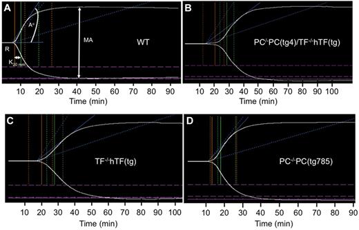 Figure 4. Thromboelastograms of recalcified mouse whole blood samples. (A) Resting WT blood. (B) Resting PC−/−PC(tg4)/TF−/−hTF(tg) blood. (C) Resting TF−/−hTF(tg) blood. (D) Resting PC−/−PC(tg785) blood. The parameters measured are shown in (A) and include R (min), K (min), A° (degrees), and MA (mm). *P < .05.