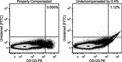 Figure 1. Improper compensation leads to incorrect gate frequency calculations. Cells were stained with a series of reagents, including CD123 conjugated to phycoerythrin, but no reagent on the fluorescein isothiocyanate (FITC) channel. (Left) The distribution of CD123 vs FITC is shown. Essentially, no events show up in the FITC channel. (Right) The compensation setting between phycoerythrin and FITC was reduced by 0.4% to illustrate the impact of undercompensation. Such an error in the estimation of the proper setting could easily be seen by using a compensation control that was not as bright as the CD123bright cells. Tell-tale signs of undercompensation are apparent, including the curved upward appearance of the distribution and the highly correlated distribution (narrow diagonal) of the brightest events. The same gate now shows more than 1% “positive” events, despite there being no FITC fluorescence on these cells.