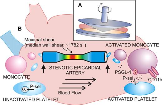 Shear-induced activation of vascular cells in vitro and in vivo. (A) Diagram of the cone-plate viscometer, where a rotating cone on a fixed plate exerts uniform shear stress on a sample of blood or platelets without exposure to a thrombogenic surface. (B) Shear stress–exposed blood passed through a stenotic coronary artery shows signs of activated platelets (increased P-selectin expression) and activated monocytes (increased CD11b) when blood samples (vertical arrows) are taken upstream or downstream of the atherosclerotic lesion from stable angina patients. The extent of stenosis and shear rates are calculated using computational angiographic imaging.