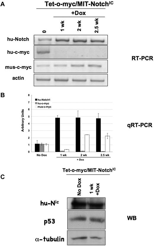 Figure 7. NOTCHIC expression is maintained in nonregressing Tet-o-MYC/MIT-NOTCHIC tumors treated with Dox. (A) RT-PCR analysis of spleens from nonregressing Tet-o-MYC/MIT-NOTCHIC tumors treated with Dox for the indicated times using the indicated specific primers. (B) Quantitative RT-PCR analysis on single-cell suspensions from spleens of nonregressing Tet-o-MYC/MIT-NOTCHIC tumors treated with Dox. (C) Western blot analysis with antibodies against the indicated proteins in nonregressing Tet-o-MYC/MIT-NOTCHIC tumors treated with Dox.