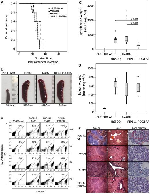 Figure 3. PDGFRA point mutations show increased lymphadenopathy compared with the FIP1L1-PDGFRA fusion in a syngeneic transplantation model. (A) H650Q and R748G are transforming in vivo. Kaplan-Meier plot shows survival of C3H/HeJ mice injected with 1.2 × 106 cells of 32D cell lines retrovirally expressing PDGFRA wt (n = 29), H650Q (n = 4), R748G (n = 15), and FIP1L1-PDGFRA (n = 5). (B) Diseased mice show significant enlargement of the spleen. Mice were killed on day 22 after injection for analysis. The numbers below the photographs depict spleen weight. (C-D) Lymph node and spleen weight of injected mice. Moribund or dead mice were analyzed for spleen and lymph node weight, controls were analyzed at various time points (range days 22-57; PDGFRA wt n = 17; H650Q n = 14; R748G n = 14; FIP1L1-PDGFRA n = 10). Included are untreated mice and mice treated with water by oral gavage. No statistical difference was observed between the 2 control groups (untreated vs water-treated) with the exception of R748G mice, because of 3 outliers which harbored greatly enlarged lymph nodes but marginally significantly smaller spleens. Statistical significance was tested with the nonparametric Mann-Whitney U test. (E) Hematopoietic and lymphatic organs show invasion of GFP-positive 32D cells. Bone marrow (BM), spleen (Spl), lymph nodes (LN), and peripheral blood cells (PB) were analyzed by flow cytometry for the presence of GFP-positive 32D cells. Depicted gates and percent values represent GFP-positive cells. Shown is 1 mouse of each group, analyzed 22 days after injection. (F) Histologic analysis of spleen, liver, and BM on day 22 after injection was performed after HE (hematoxylin/eosin) or NACE (Naphthyl acetate (chloro-)esterase) staining and showed infiltrates in the perivascular regions of the liver (arrows), a disturbed follicular structure of the spleen and remarkable reduction of NACE-positive cells in BM. Spleen and liver slides are depicted at ×10 magnification, BM at ×100.