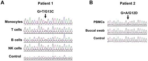Figure 1. Gain-of-function somatic KRAS mutations. (A) Cell subsets were sorted by flow cytometry and used for DNA sequencing; (B) Peripheral blood mononuclear cells (PBMCs) were lysed and used for DNA sequencing; a buccal swab was also sequenced to rule out a germline mutation. The small mutant peak seen in the buccal sample probably reflects the presence of hematopoietic cells in the cell mixture.