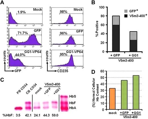 Figure 4. Augmentation of HbF and total Hb content in β-thalassemic erythroblasts derived from CD34+ cotransduced with both the V5m3-400 γ-globin and GG1-VP64/GFP lentiviral vectors. (A) Histograms of flow cytometric analysis of erythroblasts derived from CD34+ cells treated as indicated. Analysis for both GFP and CD235 at the end of the culture. (B) The percentages of CFU transduced with the GFP control or GG1-VP64/GFP vectors, as judged by GFP positivity by fluorescence microscopy, are indicated by the top of the bar (gray). The percentage of GFP+ CFU that contain the V5m3-400 vector by DNA PCR is indicated by the black portion of the bar. (C) Cellulose acetate Hb electrophoresis of lysates from erythroblasts derived from CD34+ BM cells of a β-thalassemic donor cotransduced with the indicated vectors. Percentages below each lane represent the amount of HbF, relative to total Hb, as determined by HPLC. Vertical lines have been inserted to represent repositioned lanes on the gel images. (D) The percentage of total Hb content, relative to that of erythroblasts derived from normal PB CD34+ cells, of β-thalassemic erythroblasts derived from the indicated transduced cell populations. PB CD34 indicates erythroblasts derived from cytokine-mobilized peripheral blood CD34+ cells of normal donors; and CB CD34, erythroblasts derived from CD34+ cord blood cells.