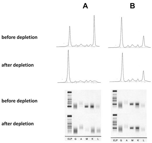 Figure 1. Absorption of IgM paraproteins with recombinant P-7. (A) IgM paraprotein with P-7 reactivity and absorption with a P-7 column. (B) IgM paraprotein with non–P-7 reactivity and absorption by a P-7 column (control). (Top) Serum electrophoresis before and after absorption, (bottom) immunofixation before and after absorption with P-7. The absorption studies of 3 sera containing a P-7 reactive IgM paraprotein and 2 IgM control paraproteins with P-7 nonreactivity yielded identical results.