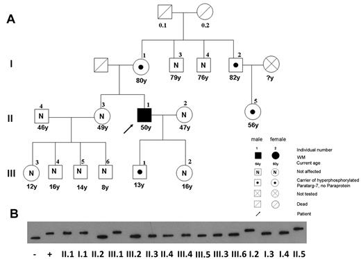 Figure 3. Pedigree of a patient with WM with a P-7–specific IgM paraprotein carrying the pP-7. (A) The pedigree shows the family of a 50-year-old man with WM (II.1), having a P-7–reactive paraprotein and carrying the hyperphosphorylated state of this protein. The pattern of a pP-7 carrier state in this family is consistent with an autosomal dominant trait. (B) Immunostaining of lysate bands derived from whole peripheral blood lysates from family members carrying wild-type (I.3; I.4; II.2; II.3; II.4; III.2; III.3; III.4; III.5; III.6) and pP-7 (I.1; I.2; II.1; II.5; III.1) after IEF. The numbers indicate family members in different generations.