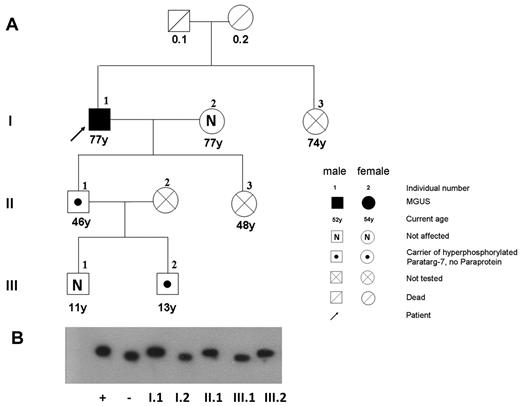 Figure 4. Pedigree of a patient with MGUS with a P-7–specific IgM paraprotein carrying the pP-7. (A) The pedigree shows the family of a 77-year-old man with IgM-MGUS (I.1), having a P-7–reactive paraprotein and carrying the hyperphosphorylated state of this protein. (B) Immunostaining of lysate bands derived from whole peripheral blood lysates from family members carrying wild-type (I.2; III.1) and pP-7 (I.1; II.1; III.2) after IEF. The numbers indicate family members in different generations.