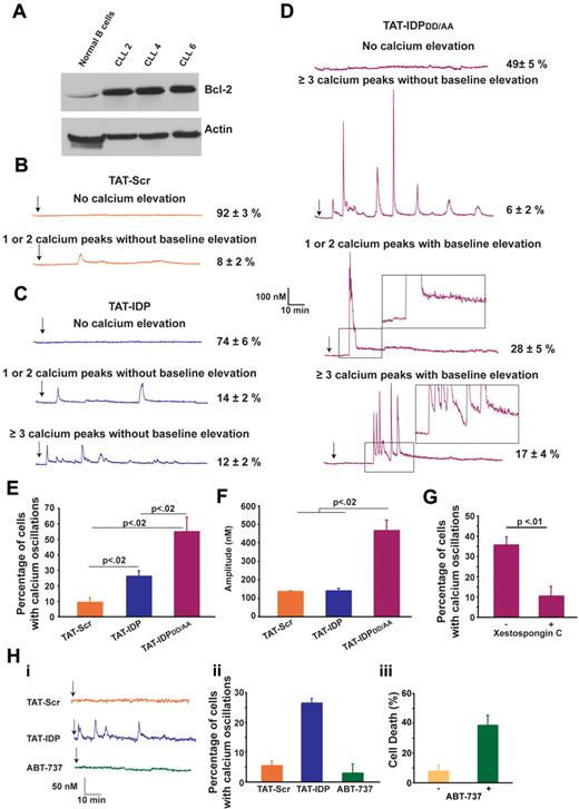 Figure 5. Peptide-induced Ca2+ oscillations in primary CLL cells. (A) Immunoblot comparing Bcl-2 levels in normal human B lymphocytes and 3 primary CLL samples. (B-D) Representative single-cell Ca2+ recordings illustrating the Ca2+ responses observed in CLL cells after addition (arrow) of 10μM of each peptide shown. Portions of the traces in panel D are magnified (insets) to illustrate the baseline Ca2+ elevation induced by TAT-IDPDD/AA. (E) Percentage of CLL cells displaying Ca2+ oscillations in response to 10μM peptide addition during 90 minutes of single-cell recordings (mean ± SE, 3 experiments each using CLL cells isolated from a different patient, average 85 cells per experiment). (F) Amplitude of individual Ca2+ spikes in the same experiments shown in panel E (mean ± SE). (G) Inhibition of peptide-induced Ca2+ oscillations by xestospongin C summarized as percentage of CLL cells displaying Ca2+ oscillations during 90 minutes of single-cell recordings after the addition of TAT-IDPDD/AA (5-10μM); cells were pretreated for 30 minutes with either DMSO (−) or 10μM xestospongin C (+) (mean ± SE, 4 experiments, average 75 cells analyzed per recording). (H) Failure of ABT-737 to induce Ca2+ elevation: (i) representative single-cell Ca2+ recordings in CLL cells, with arrow designating addition of 5μM TAT-Scr or TAT-IDP or 2μM ABT-737; (ii) percentage of CLL cells with Ca2+ oscillations in response to 5μM TAT-Scr or TAT-IDP or 2μM ABT-737, with symbols representing the mean ± SE in 2 experiments (average 80 cells per experiment); (iii) cell death (trypan blue dye uptake) in CLL cells incubated with or without 2μM ABT-737 for 24 hours, with symbols representing the mean ± SE in 7 experiments (average 400 cells counted per individual treatment).