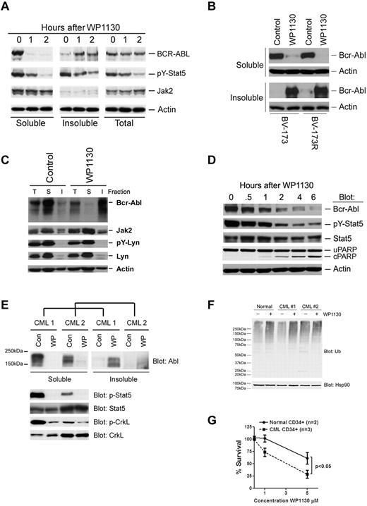 Figure 3. WP1130 induces cellular trafficking of Bcr-Abl and inhibits its substrate phosphorylation in CML cells. (A) BV-173 cells were treated with 5μM WP1130 for the intervals indicated before assessing Bcr-Abl and other protein levels in total cell lysates and in the detergent-soluble and -insoluble fractions. Actin was blotted as a protein-loading control. (B) BV-173 and BV-173R cells were treated with 5μM WP1130 for 2 hours before detergent-soluble and -insoluble cell lysates were blotted for Bcr-Abl (K12 antibody) and actin as a protein-loading control. (C) K562R cells were treated with 5μM WP1130 for 2 hours before proteins derived from the total cell lysate (T) and detergent-soluble (S) and insoluble (I) lysates were probed for Bcr-Abl and other proteins or phosphoproteins as indicated. Total cell lysate represents the detergent-soluble and -insoluble lysates combined. Actin served as a protein-loading control. (D) BaF3 cells transformed with eGFP-Bcr-Abl with the T315I mutation were treated with 5μM WP1130 for the intervals noted before detergent-soluble cell lysates were immunoblotted for the indicated protein or phosphoprotein. Actin was blotted as a protein-loading control. Loss of Bcr-Abl from the soluble (cytoplasmic) cell fraction was associated with reduced signaling (pY-Stat5) and the onset of apoptosis (cleaved PARP). (E) Mononuclear cells from 2 CML patients who were progressing on imatinib therapy were treated with 5μM WP1130 for 4 hours before cell lysates representing the combined detergent-soluble and -insoluble fractions were probed for Bcr-Abl by immunoblotting (top). The detergent-soluble cell lysate was also immunoblotted for Bcr-Abl substrate phosphoproteins (pY-Stat5, pY-CrkL), as well as Stat5 and CrkL total protein levels. (F) CD34+ cells from a healthy donor and 2 imatinib-refractory CML patients were treated with 5μM WP1130 for 4 hours before total protein lysates (8 μg) were subjected to ubiquitin immunoblotting. Hsp90 was immunoblotted as a protein-loading control. (G) CD34+ cells isolated from 2 healthy donors and 3 imatinib-refractory CML patients were treated with the indicated concentrations of WP1130 for 24 hours before analysis of cell survival by annexin/propidium iodide staining and flow cytometry. The results represent the average ± SD of 3 replicates. Statistical significance was determined with a paired Student t test.