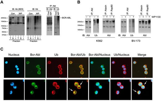 Figure 5. WP1130 stimulates Bcr-Abl ubiquitination and trafficking in CML cells. (A) WDT-2 cells were treated with vehicle alone (control) or 5μM WP1130 (WP) for 30 minutes at 37°C before an equal volume of cell lysates were resolved into total (T), detergent-soluble (S), or detergent-insoluble (I) fractions and probed for Bcr-Abl (left) or ubiquitin (center). Equal protein (400 μg) detergent-soluble cell lysate from WP1130-treated or control cells was treated with 1% SDS at 60°C, diluted to 0.1% SDS, and subjected to immunoprecipitation with anti-Abl (K12). The immunoprecipitate was washed, resolved on gels, and immunoblotted for Abl (left) or ubiquitin (right). (B) K562 or BV-173 cells were treated as described in panel A, and equal amounts of detergent-soluble cell lysates were subjected to Abl immunoprecipitation and blotting for Abl and ubiquitin (as described in panel A right). An aliquot of the same lysate (200 μg) from control and treated cells was also subjected to affinity enrichment for K48-linked (ataxin) or K63-linked (Rap80) ubiquitin polymers. Bound protein was eluted and subjected to Abl immunoblotting. (C) eGFP-Bcr-Abl–transformed BaF3 cells were treated with vehicle alone (top panel) or with 5μM WP1130 for 4 hours (bottom panel) before cells were fixed, cytospun onto slides, and permeabilized. After blocking reactive sites, slides were incubated with anti-ubiquitin antibody (1:100), washed, and antigen detected with Alexa Fluor antibodies. The slides were washed again and stained for nucleus detection with Hoechst 33342. Images were acquired using an Olympus confocal microscope FV-500 and merged with Photoshop Version 6.0 software. The arrows depict Bcr-Abl/ubiquitin colocalization, and their juxtanuclear localization resembles aggresomes.