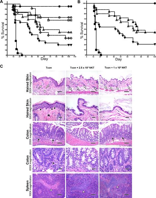 Figure 2. Adoptively transferred donor-type NKT cells protect against GVHD. (A) Doses of NKT cells (DX5+TCRβ+CD4+) from C57BL6 donors (H-2b) were adoptively transferred into lethally irradiated BALB/c mice (H-2d) that had TCD-BM and 5.0 × 105 Tcons (to induce GVHD). Significant improvement in survival was observed with the transfer of either 1.0 × 104 or 2.5 × 104 NKT cells (P < .01). Data shown in graph were pooled from 4 independent experiments. Groups: irradiation control (no BMT; ■; n = 25); TCD-BM only (●; n = 25); 5 × 105 Tcons (▾; n = 25); Tcons + 1 × 105 NKT (▵; n = 20); Tcons + 5 × 104 NKT (◇; n = 18); Tcons + 2.5 × 104 NKT (○; n = 23); and Tcons + 1 × 104 NKT (□; n = 19). (B) Further sorting of NKT cells into PBS-57 CD1d–PBS-57 tetramer-positive and tetramer-negative subpopulations indicates that both invariant and noninvariant NKT cells provide protection against GVHD (P < .05). Graph contains data pooled from 4 independent experiments (n = 25). Groups: irradiation control (no BMT; ■); TCD-BM only (●); 5 × 105 Tcons (▾); Tcons + 1 × 104 PBS-57 CD1d− NKT (▵); and Tcons + 1 × 104 PBS-57 CD1d+ NKT (▴). (C) Mice were euthanized at day 39 after transplant. Samples of haired skin, small intestines, large intestines, liver, thymus, spleen, and mesenteric lymph nodes were collected and fixed in formalin for 48 hours before being routinely processed for histologic analysis of stained sections. Evidence for acute GVHD pathology in the haired skin as follows: reduced number of follicles (white arrows), increased inflammation in the panniculus (white asterisk), increased epidermal thickness because of hyperplasia (white measurement bar), increased density of dermal collagen (black asterisk), and mild vacuolar degeneration of the stratum basale with presence of apoptotic bodies (black arrowheads). GVHD-associated colitis was noted with increased numbers of lymphocytes and plasma cells in the lamina propria (black arrows) Increased numbers of intraepithelial lymphocytes are also present. A decreased number of goblet cells is observed, along with evidence of gland regeneration (hyperbasophilia of gland enterocytes, along with increased mitoses and nuclear crowding). Apoptotic bodies (black arrowhead) are present within the glands as well. Severe atrophy (lymphoid depletion) of the lymphoid follicles of splenic white pulp areas (white arrowhead) was noted in the mice receiving Tcon cells only. 100× magnification bar = 200 microns; 200× magnification bar = 100 microns; 600× magnification bar = 25 microns.