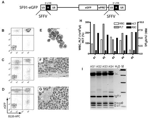 Figure 1. Prolonged ex vivo cultivation (13 days) of murine HSCs in combination with gammaretroviral insertional mutagenesis triggers leukemogenesis. (A) Schematic representation of an integrated gammaretroviral LTR-driven SF91-eGFP vector. Indicated are the 5′ and 3′ LTRs consisting of U3, R, and U5 regions. The SFFV promoter is located in both U3 regions and drives the expression of eGFP. (B-D) Representative fluorescence-activated cell sorting analysis for eGFP and B cell–specific B220 expression in leukemic mouse bone marrow (B), spleen (C), and peripheral blood leukocytes (D). (E) Cytospin of bone marrow, (F) histology of spleen, and (G) liver sections showing blasts and infiltrates of leukemic cells (all at 1000× magnification). (H) Blood counts of 5 mice transplanted with the aforementioned leukemia. WBC indicates white cell count; PLT, platelet count; HCT, hematocrit; and RBC, red blood cell count. (I) LM-PCRs on genomic DNA of splenocytes from mice AS1, AS2, AS3, and AS4. Vector integration sites identified by sequencing are indicated. i.c. indicates internal control; and M, marker.