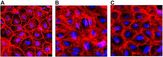 Figure 5. FVIIa prevents thrombin-induced cytoskeletal rearrangement. HUVEC monolayers were treated with a control vehicle (A-B) or FVIIa (10nM; C) for 2 hours, and then with thrombin (5nM) for 10 minutes (B-C). The cells were fixed, permeabilized, and stained with rhodamine-conjugated phalloidin to detect F-actin. Cells were imaged using a confocal system (LSM 510 META; Zeiss) equipped with an Axio Observer Z1 microscope (Zeiss).