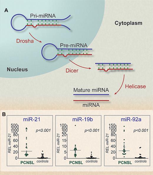 (A) Model for miRNA biogenesis. The initiation step is mediated by the Drosha complex in the nucleus. The product of this nuclear processing step is an ∼ 70-nucleotide pre-miRNA. After export, the cytoplasmic RNase III dicer participates in the second processing step (dicing) to produce miRNA duplexes. The duplex is separated by helicase and usually one strand is selected as the mature miRNA, whereas the other strand is degraded. (B) Scatter plots of expression levels of miR-21, miR-19b, and miR-92a in CSF samples from 23 PCNSL patients compared with 30 control patients with various neurologic disorders. Increased mean and median relative expression levels of miR-21, miR-19b, and miR-92a were demonstrated in PCNSL patients' CSF compared with controls. Professional illustration by Debra T. Dartez.