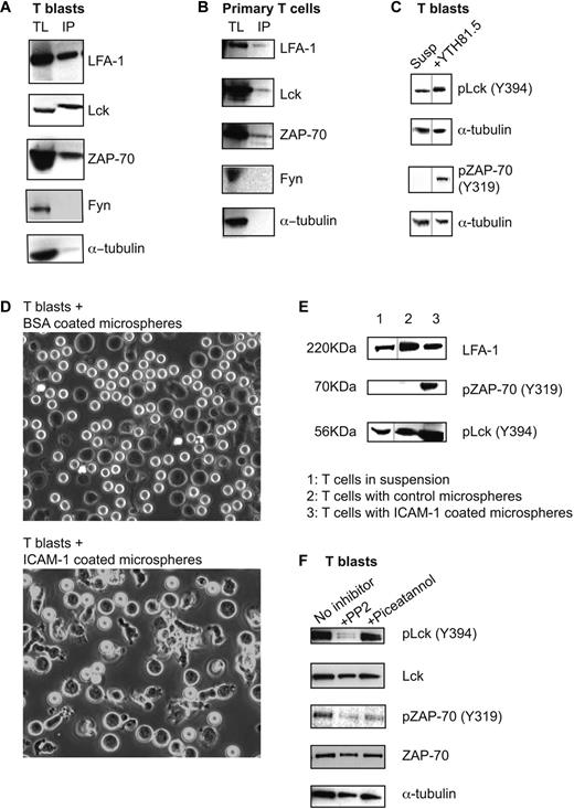 Figure 1. LFA-1 is associated with Lck and ZAP-70 in a signaling complex that is activated in response to LFA-1 binding to ICAM-1. (A) Total T-lymphoblast lysate (TL); LFA-1 immunoprecipitates from T lymphoblasts in suspension (IP) blotted for the presence of LFA-1, Lck, ZAP-70, Fyn, and α-tubulin; n = 4. (B) Total primary T-lymphocyte lysate (TL); LFA-1 immunoprecipitates from primary T lymphocytes in suspension (IP) blotted for the presence of LFA-1, Lck, ZAP-70, Fyn, and α-tubulin; n = 3. (C) Lysates of T lymphoblasts either in suspension (Susp) or treated with pan–LFA-1 mAb YTH81.5 and blotted for phospho-Lck (Y394), phospho-ZAP-70 (Y319), and α-tubulin; n = 4. Black vertical lines indicate images taken from separate tracks on the blots. (D) T lymphoblasts were incubated with either ICAM-1– or BSA-coated microspheres for 15 minutes at 37°C. Typical wide field images are shown of the interaction of the T cells (dark images) with the coated microspheres (white spheres). (E) T blasts were incubated for 30 minutes with the microspheres, then lysates were made and blotted for total LFA-1 (control), phospho-Lck (Y394), and phospho-ZAP-70 (Y319). Black vertical lines indicate images taken from separate exposures of the blots. (F) T lymphoblasts either untreated or treated with 40μM PP2 or 10μM piceatannol were incubated on ICAM-1–coated plates. Lysates were probed for phospho-Lck (Y394), total Lck, phospho-ZAP-70 (Y319), total ZAP-70, and α-tubulin by Western blotting; n = 3.