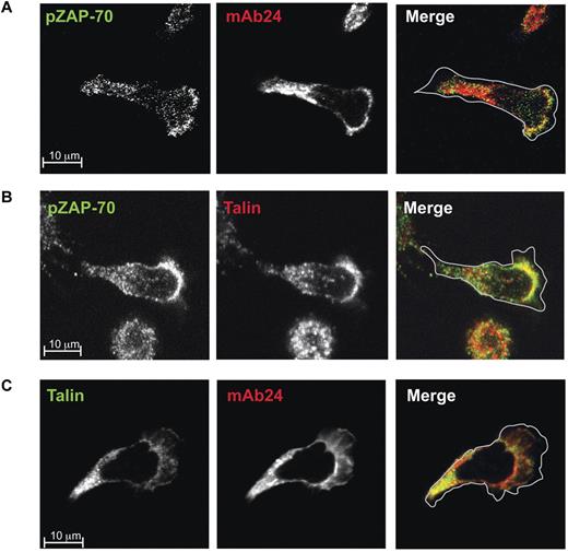 Figure 3. Phospho-ZAP-70 colocalizes with high-affinity LFA-1 and talin at the lamellar/lamellipodial interface of migrating T cells. Confocal images of typical T lymphoblasts fixed on ICAM-1 before mAb staining. Images were taken at substrate level and merged images are shown in the right panel. The cells were stained with Alexa 546–conjugated mAb 24 or with mAbs specific for phospho-ZAP-70 and talin which were detected with the Alexa 488 or Alexa 546–conjugated anti–mouse IgG: (A) phospho-ZAP-70 (Y319; green) and mAb 24 (red); (B) phospho-ZAP-70 (Y319; green) and talin (red); (C) talin (green) and mAb 24 (red).
