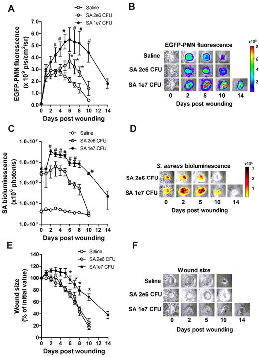 Figure 1. Effects of S aureus inoculum on PMN trafficking and tissue healing. EGFP-lys-mice were inoculated with saline or low-dose S aureus (2 × 106 CFUs, SA-2e6 CFUs), or sublethal high dose S aureus (1 × 107 CFUs, SA-1e7 CFUs) on back skin wounds, and kinetics of wound EGFP-PMN fluorescence (A-B), S aureus (SA) bioluminescence (C-D), and wound closure (E-F) were determined. Depicted are representative images of wound EGFP-PMNs (B), bioluminescent S aureus (D), and wound size (F). Data are derived from 6-8 mice in each group and are expressed as means ± SEM. *P < .05 vs saline group; #P < .05 vs SA-2e6 CFU group.