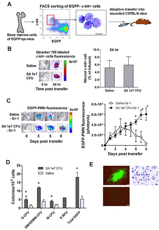 Figure 5. Bone marrow–derived c-kit+ progenitors recruit to wounds and give rise to EGFP-PMNs in the presence of S aureus. (A-C) Adoptive transfer of EGFP−c-kit+ cells from EGFP-lys-mice into C57BL/6 wild-type mice. (A) FACS-sorted EGFP−c-kit+ cells were labeled with Qtracker 705 and intravenously transferred (5 × 105 cells in 0.1 mL of sterile saline) to C57BL/6 mice whose wounds were treated with either sterile saline or S aureus (1 × 107 CFUs). (B) Emigrated Qtracker 705–labeled EGFP−c-kit+ cells were detected at 24 hours after transfer in wounds (n = 2 mice in each group). (C) Kinetics of EGFP-PMNs within the S aureus–infected wound after adoptive transfer of EGFP−c-kit+ cells. *P < .05 vs saline-Gr-1 group. Data are derived from 3-4 mice in each group. (D-E) Ex vivo G-CFU assay of wound cells harvested from EGFP-lys-mice treated with saline or S aureus (1 × 107 CFUs). (D) Three days after wounding, S aureus (1 × 107 CFUs)– or saline-treated skin wounds were collected from EGFP-lys-mice, digested, and plated in methylcellulose medium. Data are from 3 separate experiments and represent mean colony counts from S aureus (n = 5 mice)– and saline (n = 3 mice)–treated wounds analyzed 7 days after plating. *P < .05 vs saline group. GM/GEMM indicates granulocyte-macrophage/granulocyte, erythroid, megakaryocyte, macrophage; G, granulocyte; M, monocyte; and E-BFU, erythroid blast-forming unit. (E) Clockwise from top left, EGFP+ colony from S aureus–infected wound, cytospin of cells extracted from an EGFP+ G-CFU colony, and representative negative control non-EGFP colony. CFU images are overlays of phase-contrast and fluorescent images taken with a 20× objective (bar represents 50 μm). The cytospin image was taken with a 50× objective (bar represents 10 μm). Data are expressed as means ± SEM.