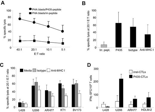 Figure 5. P435/NLT–specific CTLs are cytotoxic to PRAME+ tumor cell lines. (A) Cytotoxic activity of P435/NLT–specific CTLs toward autologous PHA blasts loaded with NLV-irrelevant peptide or loaded with the NLT peptide. Data represent the means ± SD of PRAME-CTLs from 7 healthy donors. (B) Data at a 20:1 E:T ratio of P435/NLT–specific CTLs against autologous PHA blasts loaded with NLV-irrelevant peptide or loaded with the NLT peptide preincubated with isotype control or an anti–HLA class I antibody to confirm MHC-restricted killing. (C) Cytotoxic activity of P435/NLT–specific CTLs toward PRAME+ HLA-A*02+ tumor cell lines evaluated using a standard 51Cr-release assay. As negative controls, we used the L428 tumor cell line (PRAME+ but HLA-A*02−). Killing of PRAME+HLA-A*02+ cell lines was significantly higher than that of the PRAME+HLA-A*02− L428, and was inhibited by preincubation with an anti–HLA class I antibody but not by an isotype control. (D) IFNγ ELISpot release of P435/NLT–specific CTLs or control/irrelevant CTLs against the indicated PRAME+ HLA-A*02+ cell lines or the control PRAME− HLA-A*02+ cell line.