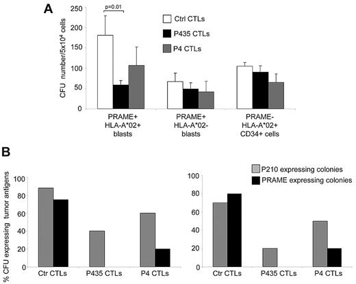 Figure 6. P435/NLT–specific CTLs target primary tumor cells and tumor progenitors. We performed clonogenic assays using peripheral and bone marrow MNCs from patients with CML to test antitumor activity by PRAME-CTLs against tumor progenitors. (A) CFUs generated from MNCs of PRAME+HLA-A*02+ and PRAME+HLA-A*02− CML patients with active disease and HLA-A*02+CD34+ cells from healthy donors incubated with P435/NLT–specific CTLs, P4-specific CTLs, or control CTLs (targeting the MART1-derived ELA epitope or the pp65-derived NLV peptide). P435/NLT–specific CTLs had a specific cytotoxic activity against PRAME+HLA-A*02+ leukemic precursors, because the number of CFUs was significantly lower when MNCs were coincubated with P435/NLT–specific CTLs compared with control CTLs (P = .01). (B) Expression of PRAME and the oncogenic fusion BCR-ABL (p210) transcript using Q-RT-PCR in colonies collected from 2 independent experiments. P435/NLT–specific CTLs almost completely eliminated the growth of PRAME+ CFUs and significantly reduced the growth of BCR/ABL+ CFUs.