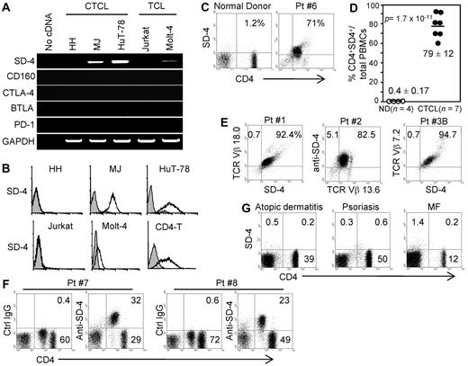 Figure 1. Expression of SD-4 by CTCL lines and PBMCs from SS patients. (A) Total RNA isolated from 3 CTCL or 2 non-CTCL T-cell leukemia (TCL) lines was examined by reverse transcription-PCR for mRNA expression of SD-4, coinhibitors (CD160, CTLA-4, BTLA, and PD-1) or glyceraldehyde-3-phosphate dehydrogenase. (B) The 5 cell lines and normal in vitro–activated CD4+ T cells (CD4-T) were also assayed by flow cytometry for surface expression of SD-4. Positive (open histogram) and control (shaded histogram) staining are shown. (C-D) PBMCs freshly isolated from 7 patients with SS in different stages of lymphomalignancy (Table 1) or 4 normal donors (ND) were examined by flow cytometry for surface expression of SD-4 on CD4+ T cells. Dot plots shown are representative for healthy donors and patients with SS (Pt. 6). (C). Frequency of SD-4+CD4+ cells in total PBMCs of each patient and normal donor is shown as a percentage and plotted in a scatter chart as mean (± SD). P was evaluated by the Student t test. (D-E) PBMCs from 3 patients with SS (Pt. 1 to Pt. 3B) were also examined for SD-4 expression on clonal malignant T cells (TCR-Vβ subtype-positive). (F) PBMCs from Pt. 7 and Pt. 8 (with low tumor burden) contained CD4low and CD4high subpopulations, each of which was examined for SD-4 expression. CD4low and CD4high cells were negative and positive, respectively, for CD26 expression (data not shown). (G) PBMCs freshly isolated from patients with atopic dermatitis, psoriasis, or MF (each 3 patients) were also assayed for SD-4 expression on CD4+ T cells. Data shown represent each disease group.