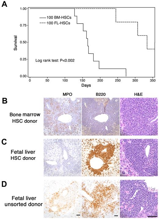 Figure 1. MLL-AF9 leukemia from fetal liver differs from that originating in postnatal marrow. (A) The latency of leukemia in recipient mice that received 100 hematopoietic MLL-AF9 stem cells (HSCs) from either embryonic day (E) 14.5 fetal liver or adult bone marrow. (B-D) Immunohistochemisty for myeloperoxidase (MPO), CD45R/ B220, and morphology of hematoxylin and eosin–stained cells on the sections from liver of leukemic mice showing leukemia that developed in recipients of fetal liver or bone marrow. All vertical panels are at the same magnification; bars represent 50 μm. Images were taken with a Spot Insight Wide-field 4 MP CCD Scientific Color Digital camera (Diagnostic Instrument) mounted on a Nikon Eclipse 80i microscope (Nikon Plan Apo 20×/0.75 or Plan Fluor 60×/0.85); image size was adjusted in Photoshop CS3 Version 10.0.1 (Adobe Systems). (B) Recipient of HSCs from adult marrow. Leukemia cells are MPO-positive, CD45R/B220-negative and show nuclear lobulation and indentation consistent with granulocytic differentiation. (C) Recipient of HSCs from fetal liver. Leukemia cells are MPO-negative, B220-positive and are large with large round, blastlike nuclei consistent without evidence of lineage-specific differentiation. (D) Recipient of unsorted cells from fetal liver. Leukemia cells are both MPO- and B220-positive and show no evidence of lineage-specific differentiation.