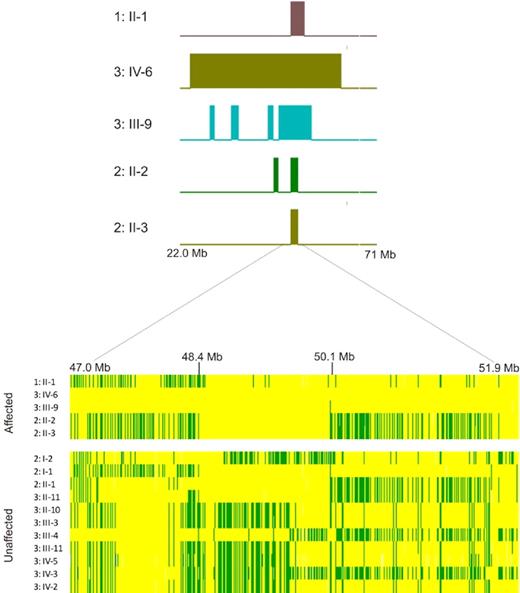 Figure 2. Homozygosity mapping in 3p21. Regions of homozygosity shared by affected persons in 3p21. (Top) Regions exported directly from the Affymetrix Genotyping Console that are homozygous in the patients affected with GPS. A 5-Mb region is expanded below. The genotypes were exported from the Affymetrix Genotyping Console software Version 4.0 into an Excel file. The regions in yellow represent those SNPs where persons are homozygous; green, heterozygotes are heterozygous for the SNPs. The affected are homozygous for most of this 1.7-Mb region between 48.4 and 50.1 Mb. The majority of unaffected persons in families 1 and 2 are heterozygous for most of this region.