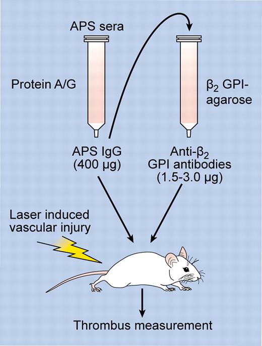 Experimental approach. APS sera was used as a source of APS IgG, which was purified using protein A/G beads. APS IgG was then either tested directly for its effects on thrombosis after laser-induced vascular injury (in which case a minimum of 400 μg was required to induce thrombosis), or used as a source for affinity purification of anti-β2GPI antibodies using immobilized β2GPI. The ability of anti-β2GPI antibodies to enhance thrombosis was then assessed after infusion of anti-β2GPI antibodies into mice (only 1.5-3.0 μg of IgG was required to enhance thrombosis). Professional illustration by Kenneth X. Probst.