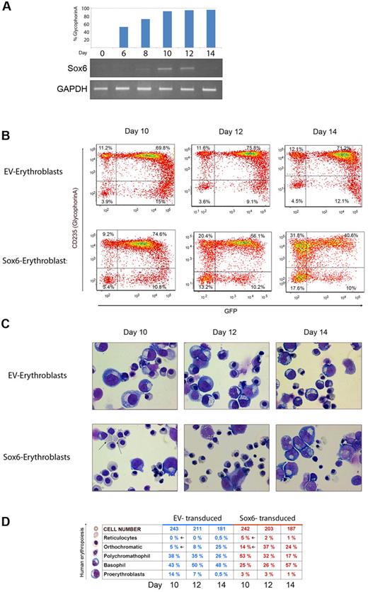 Figure 2. Sox6 enhances erythroid differentiation in cord blood–derived cell cultures. (A top panel) Percentage of GpA+ cells, estimated by FACS analysis on different days of the culture. (Bottom panel) Semiquantitative reverse-transcription PCR on the same days. Gels show Sox6 expression (top gel) and glyceraldehyde-3-phosphate dehydrogenase (GAPDH; bottom gel). (B) FACS analysis on erythroblasts transduced either with the EV (EV-erythroblasts) or the Sox6-overexpressing vector (Sox6-erythroblasts). The x-axis represents GFP expression; y-axis, GpA expression. (C) May- Grünwald-Giemsa staining on cytospin preparations of the same samples as above. (D) Differential counts on cells from the same cells as in panel C. More than 200 cells were scored for each sample.