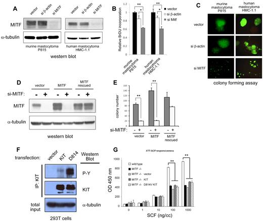 Figure 4. MITF knockdown inhibits cell growth in c-KIT mutant cells. (A) Western blot shows efficient knockdown of MITF protein expression with sh-RNA-expressing lentivirus (si-MITF) in murine (P815) and human (HMC-1) mastocytoma lines. Control lentivirus targeting β-actin (si-β-actin) shows no effect on MITF expression. (B) MITF repression results in decrease in cell proliferation. BrdU incorporation of both murine and human mastocytoma cells with si-MITF–expressing lentivirus is decreased approximately 40% of control. *P < .5. **P < .005. (C) MITF repression significantly impairs colony-forming capacity of mastocytoma lines. Representative images of mastocytoma colonies transduced with lentiviral empty vector, si-β-actin, and si-MITF in methylcellulose. Murine (P815) and human (HMC-1.1) cells with knockdown of MITF (si-MITF) are impaired in colony-forming capacity. Lentiviral vector expresses green fluorescent protein, and green fluorescent protein–expressing cells are visualized (original magnification ×10). Fluorescent images were obtained with a Nikon fluorescent microscope with excitation filter set at 488 nm. Images were cropped with Photoshop Elements 2.0 (Adobe Systems). (D) MITF resistant to silencing (MITF rescued) restores colony-forming capacity. For controls for potential off-target effects of sh-RNA and lentivirus, an MITF-expressing retrovirus with and without the si-RNA target site was constructed. Western blot shows human mastocytoma cells (HMC-1.1) expressing MITF with si-RNA binding site mutated (MITF rescued) is resistant to silencing, but the wild-type MITF-expressing cells (MITF) are not. (E) Human mastocytoma cells (HMC-1.1) are dependent on MITF expression for colony formation. Knockdown of MITF with the si-MITF-expressing lentivirus impairs colony formation MITF-expressing cells (vector and MITF, white bars), but cells with MITF resistant to silencing (MITF rescued) maintain colony-forming capacity. **P < .005. (F) Constitutive tyrosine phosphorylation of mutant D814V KIT. 293T cells were stably transduced with vector, wild-type KIT, and mutant D814V retrovirus and then immunoprecipitated with an anti-KIT antibody. Western blots performed for phosphotyrosine and KIT expression. Both wild-type and D814V KIT-transduced cells show expression of KIT, but only D814V KIT-transduced cells show significant constitutive tyrosine phosphorylation. Total input from immunoprecipitated lysates was probed for α-tubulin expression and showed roughly equivalent starting material. (G) D814V requires MITF expression for mast cell growth. Cell proliferation of BMMCs in response to SCF (72 hours incubation) was measured with XTT assay (measured at OD 450 nm). Wild-type BMMCs (white bars) proliferate in response to SCF; MITF−/− BMMCs (black bars) do not proliferate as well to high doses of SCF. MITF−/− BMMCs transduced with vector (horizontal bars), KIT (gray bars), or mutant D814V KIT (diagonal bars) retrovirus do not restore proliferative capacity of MITF−/− cells. **P < .005. P values are calculated with Student t test; all experiments performed in triplicate.
