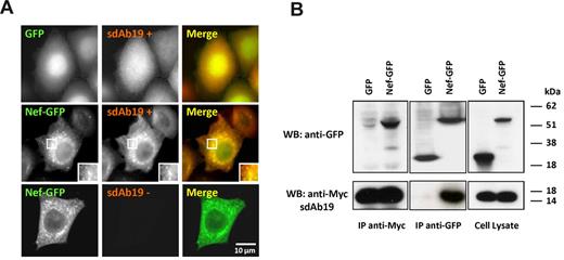 Figure 1. Association of sdAb19 with Nef. HeLa (A) or 293T (B) cells were transfected with the vector for expression of the c-Myc–tagged sdAb19 in combination with vector for expression of either Nef-GFP or GFP. (A) Intracellular distribution of Nef-GFP and sdAb19. sdAb19 was detected by indirect immunofluorescence with anti–c-Myc in Nef-GFP– (middle and bottom) or GFP-expressing cells (top). (B) Coimmunoprecipitation of Nef-GFP and sdAb19. Cell lysates (right) were submitted to immunoprecipitation with anti–c-Myc (left) or anti-GFP (center). Immunoprecipitates were analyzed by Western blotting with the use of anti-c-Myc (bottom) or anti-GFP (top). IP indicates immunoprecipitate.