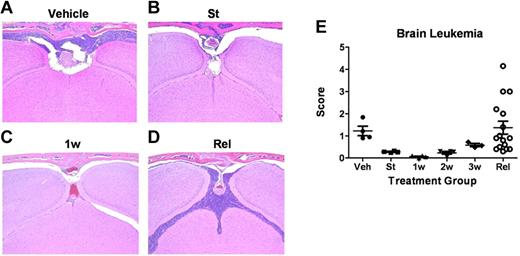 Figure 5. Leukemia-cell infiltration into the brain. (A-D) Formalin-fixed, decalcified, paraffin-embedded sections from the heads of mice were stained with hematoxylin and eosin and examined for the presence of leukemic infiltration of meninges, brain parenchyma, and bone marrow within the overlying calvaria. (A) Coronal sections from moribund, vehicle-treated mice 13 days after receipt of LICs showed characteristically high levels of leukemic-cell infiltration into the meningeal layer associated with filling of bone marrow space in overlying calvaria. (B) At the start (St) of dasatinib therapy 10 days after LIC injection, recipients typically harbored detectable leukemic infiltrates in the meninges. (C) Infiltrates decreased significantly after 1 week (1w) of dasatinib therapy. (D) Significant leukemic expansion was observed in all mice that ultimately relapsed despite continuous dasatinib therapy. (E) Leukemia infiltration of the CNS of recipients was reviewed and scored by a blinded veterinary pathologist from mice at the start of dasatinib therapy (St; n = 4); after 1 week (1w; n = 4), 2 weeks (2w; n = 4), or 3 weeks (3w; n = 4) of twice-daily (5 days per week) dasatinib therapy; or at clinical relapse (Rel; n = 15). This panel depicts the leukemic infiltration score in mice at the indicated times; scores represent the thickest portion of lymphocyte infiltration of all sections reviewed and are expressed in micrometers.