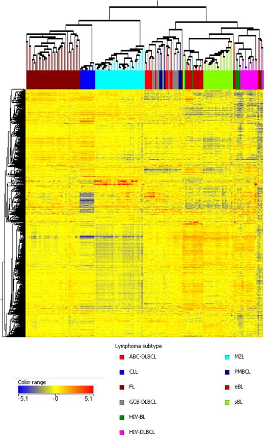 Figure 1. BL is a unique entity distinct from other B-cell malignancies. The unsupervised hierarchical clustering, based on the expression of the 9848 most informative genes, clearly separated the different diseases. In particular, eBL, sBL, and HIV-BL were grouped within a unique cluster. The dendrogram was generated with the use of a hierarchical clustering algorithm that was based on the average-linkage method. In the matrix, each column represents a sample and each row represents a gene. The color scale bar shows the relative gene expression changes normalized by the standard deviation (0 is the mean expression level of a given gene).