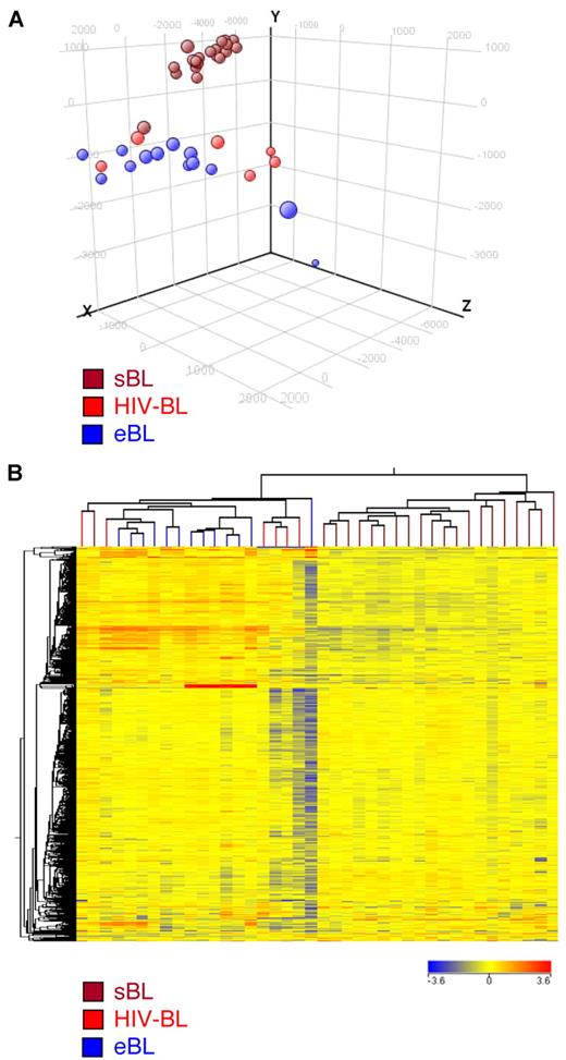 Figure 2. BL subtypes present with differences in their GEPs. Both unsupervised analyses, principal component analysis (A) and hierarchical clustering (B), could discriminate the 3 different BL subtypes. Notably, eBL and HIV-BL appeared to be strictly related.