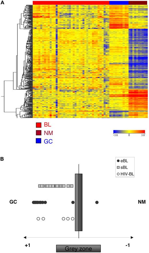 Figure 4. Relatedness of the GEP of BL to normal B-cell populations. Analysis of genes associated in normal B cells to the GC transitions in BL. The genes that are differentially expressed in naive, memory, and GC B cells during the GC transit were identified by supervised analysis. The expression of the transition genes is investigated in BL. All BL cases are more related to GC B cells than to naive/memory cells, irrespectively of the clinical subtype (A). A cell-type classification is used to measure the relatedness of BLs to naive/memory (NM) and germinal center (GC) B cells. The gray area marks 95% of confidence; the P value decreases with increasing distance from the x-axis (B).