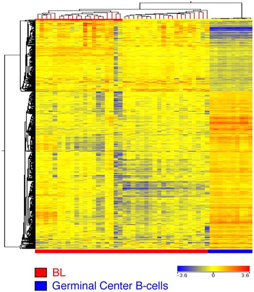 Figure 5. Identification of genes differentially expressed in BL and normal GC B lymphocytes. Supervised analysis was performed with the use of 40 BL samples versus the 10 normal GC B-cell samples identified as the closest normal counterparts. The analysis identified 1956 probe sets (1331 genes) that are differentially expressed in BLs versus normal samples (supplemental Table 6).