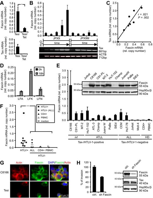 Figure 1. HTLV-1 Tax induces Fascin in T cells. (A) Quantitative PCR of Fascin mRNA in the presence (Tesi) and absence (Tesi/Tet) of Tax; for complete Tax repression, cells were grown in medium containing 1 μg/mL tetracycline for 10 days (Tesi/Tet). Relative copy number was determined by normalizing Fascin and Tax transcripts to those of β-actin (ACTB). Mean values ± SE were compared using a paired t test (n = 4). *P < .05. (B) Representative diagram of Fascin (quantitative PCR) and Tax (RT-PCR) mRNA in Tax-inducible JPX9 cells (wt-Tax) and control cells JPX9M (inactive Tax mutant) after incubation with 20μM CdCl2 for 0, 6, 12, 24, and 48 hours. (C) Test of Fascin and Tax copy numbers (quantitative PCR) for correlation using Pearson test after transfection of Jurkat T cells with increasing amounts of pcTax (0, 5, 10, 15, 20, 25, 30, and 35 μg) replenished with pcDNA3.1 to 40 μg. (D) Quantitative PCR of Fascin mRNA in freshly isolated CD4+ T lymphocytes from ATLL patients LFA, LFK, and LFN directly after isolation (t = 0 hours) and 18 hours after cultivation. (E) Quantitative PCR and immunoblot of Fascin. Relative copy number was determined by normalizing Fascin transcripts to those of ACTB. The means of 3 independent experiments ± SE are shown. ivt indicates in vitro-transformed; ATLL, derived from adult T-cell leukemia/lymphoma; ALL, derived from acute lymphoblastic leukemia; and HD, healthy donors. In immunoblots, detection of Hsp90α/β served as loading control. (F) Comparison of Fascin copies between HTLV-1/Tax-positive cells shown in panel E and uninfected controls (ALL, CD4+, PBMCs) using a 2-tailed Mann-Whitney test (n = 3). **P < .01. Horizontal bars represent the median; ■, HTLV-1-transformed cells; ●, HTLV-1-negative ALL cells; ▴, CD4+ T lymphocytes from HD; and ▵, PBMCs from HD. (G) Immunofluorescence of C8166 (HTLV/Tax+) and Tesi (Tax+) cells using Phalloidin X-Texas Red for detection of actin and anti-Fascin and secondary anti–mouse Alexa Flour 488 antibodies. Images were acquired using a Leica LAS AF DMI 6000 fluorescence microscope equipped with a 63× ACX PL APO oil immersion lens and a Leica DFC 360 FX camera. Leica Application Suite 2.0.2 software was used. (H) Comparison of invasion of ATLL-derived, serum-starved HuT-102 cells, transduced with lentiviral vectors expressing either a nonsense shRNA (ctrl.) or shFascin, into extracellular matrix in transwell assays performed in quadruplicate. In immunoblots, protein expression of Fascin, Tax, and Hsp90α/β was controlled. One representative experiment is shown.