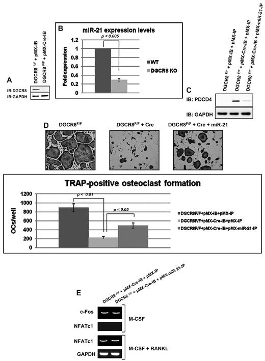 Figure 4. miR-21 rescued osteoclastogenesis in DGCR8-deficient BMMs. (A) Immunoblotting analysis of DGCR8 of DGCR8F/F BMMs (pMX-IB) and DGCR8-deficient BMMs (pMX-Cre-IB) without RANKL treatment. (B) QRT-PCR was performed with primer for miR-21. The PCR products were normalized to U6 level for each reaction. The data represent the means ± SDs of 3 experiments in triplicate. WT indicates DGCR8 wt BMMs. (C) Immunoblotting analysis of PDCD4 in infected BMMs without RANKL treatment. (D) TRAP-positive multinucleated cells counted at 3 days after RANKL treatment, cultured in 24-well plates (200×). Similar findings were obtained in 4 independent sets of experiments. (E) RT-PCR analysis of the genes related to osteoclastogenesis. OC indicates osteoclast.