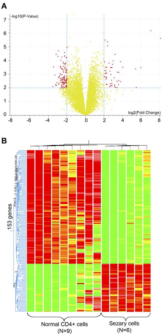 Figure 1. Transcriptome analysis of primary Sézary cells. (A) Volcano plot of the 153 differentially expressed genes identified from RNA prepared from CD4+CD7+ Sézary cell from 6 SS patients compared with similarly purified cells from 9 normal volunteers that were used to perform transcriptome analysis on 41 059 gene transcripts. Red dots represent differently expressed genes with fold changes more than 4. P < .01. Genes on the right arm are overexpressed in Sézary cells, whereas those on the left arm are underexpressed in Sézary cells. (B) Hierarchical unsupervised clustering of the 153 genes, which clearly demonstrates a separation between Sézary cells and the normal T lymphocyte controls.