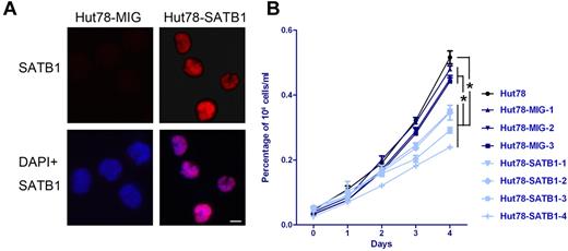 Figure 4. Retrovirus-mediated SATB1 gene transduction confers growth disadvantage to Hut78 cells. (A) Immunofluorescence analysis show that Hut78 cells transduced with SATB1 gene in retrovirus vector (Hut78-SATB1) stably express SATB1 protein in cell nucleus, whereas control cells transduced with empty vector (Hut78-MIG) do not express SATB1. Original magnification ×630. Scale bar represents 10 μm. (B) Parental Hut78 cells (black) and Hut78-MIG cell clones (navy) present growth advantage over SATB1-transduced cell clones (light blue). On day 4, the viable cell numbers of Hut78-SATB1 cell clones were significantly lower than those of parental Hut78 cells and Hut78-MIG cells. Data were generated from the individual cell clones from each group, and all experiments were triplicated. *P < .05 by Mann-Whitney U test.