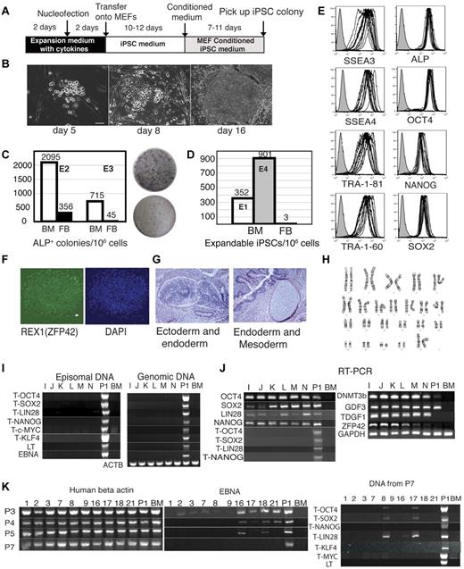 Figure 1. Efficient generation of transgene-free iPSCs from BM mononuclear cells. (A) Schematic diagram of reprogramming protocol. (B) Kinetics of morphologic changes after blood reprogramming. (C-D) Comparison of reprogramming efficiency between blood cells and fibroblasts. (C) Left graph shows the numbers of ALP+ colonies per 1 million BM cells and fibroblasts (FB) transfected side by side with combination 19 episomal vectors. Two independent experiments, E2 and E3, are shown. Right panel shows ALP staining of colonies generated after transfection and the first passage on MEFs 2 × 105 BM cells (top) and 3.3 × 105 fibroblasts (bottom). (D) Expandable iPSC colonies obtained from 1 million FB and BM cells transfected with the same set of reprogramming factors. Black bar shows the number of iPSC colonies generated from foreskin fibroblasts in our previous studies.14 Bars in E1 and E4 show results of reprogramming of BM mononuclear cells from 2 independent experiments (E1 and E4). (E) Flow cytometric analysis of hESC-specific marker expression in 7 BM iPSC lines and 6 subclones generated from BM iPSC1. (F) Representative immunofluorescent staining of BM iPSCs with REX1 antibody. Bar indicates 50 μm. (G) H&E staining of teratoma from representative BM iPSC line (BM iPSC1M). Neuronal rosette and gastro-intestine-like structure can be seen in the left panel. Cartilage and gut epithelium can be seen in the right panel. Bars indicate 50 μm. (H) Normal karyogram representative of BM iPSC (BM iPSC1M). (I) PCR analysis of episomal and genomic DNA in subclones I-N obtained from the BM iPSC1 line. Human BM genomic DNA serves as negative control (BM), whereas DNA samples from human BM mononuclear cells transfected with the same constructs are used as a positive control (P1). T indicates that transgene specific primers were used. (J) RT-PCR analysis of expression of transgenes and endogenous pluripotency genes in subclones I-N obtained from the BM iPSC1 line. The T series of primers are transgene-specific. Negative controls (BM) are results of untransfected BM RNA. Positive controls (P1) are BM cells transfected with the same reprogramming plasmids. (K) Progressive loss of episomal plasmid from BM iPSC lines. Ten randomly selected BM iPSC lines (1-3, 7-9, 16-18, and 21) were analyzed. Vector-specific primer pairs (EBNA, middle panel) were used to examine the episomal DNA from different passages (passage 3, 4, 5, and 7) of the BM iPSC lines. Samples of passage 7 were further examined by other transgene-specific primers (right panel). Left panel shows existence of genomic DNA (human actin genomic primers) in the episomal DNA extracted using the previously published method.16