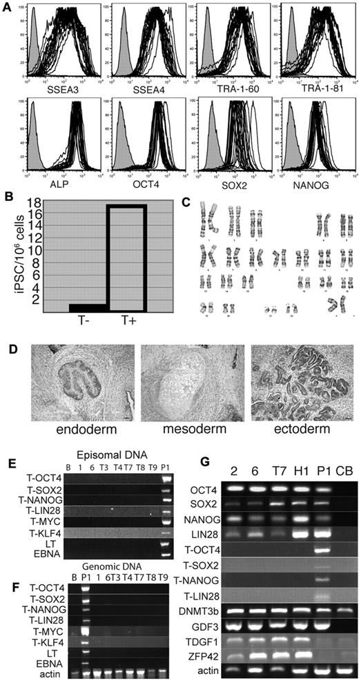 Figure 3. Reprogramming of CB mononuclear cells with nonintegrating constructs. (A) All 22 CB iPSC lines express hESC-specific surface markers as indicated, and express OCT4, NANOG, and SOX2. iPSC lines checked are: CB iPSC1 to CB iPSC6, CB iPSCT1 to CB iPSCT10, CB iPSCT12 to CB iPSCT16, and CB iPSCND. (B) Thiazovivin (T+) promotes reprogramming of CB mononuclear cells. The numbers of iPSC lines generated from 1.7 × 106 transfected CB mononuclear cells are shown. (C) Normal karyogram of the CB iPSC6 line. (D) H&E staining of representative terotoma from CB iPSCs with derivatives of 3 germ layers. (E-G) CB iPSCs cells are free of transgene and episomal DNA. Episomal DNA (E) and genomic DNA (F) were prepared from CB iPSC lines of CB iPSC1, CB iPSC6, and CB iPSCT3, -4, -7, -8, and -9. RT-PCR analysis of expression of transgenes and endogenous pluripotency genes. T-transgene–specific primers were used as indicated.