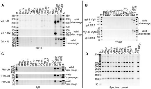 Figure 5. Analyses of TCR and IGH rearrangement in BM and CB iPSC lines. (A) PCR analyses of TCRB rearrangements. (B) PCR analyses of TCRG rearrangement. (C) PCR analyses of IGH rearrangements. FR indicates framework. (D) Specimen controls. M indicates the 50-bp DNA ladder; H2O, no template control; H1, genomic DNA from hESC H1 (negative control). Eleven iPSC lines were examined as indicated. IVS-0000 is a polyclonal control DNA; IVS-0009, IVS-0004, IVS-0021, IVS-0030, and IVS-0029 are clonal control DNAs.