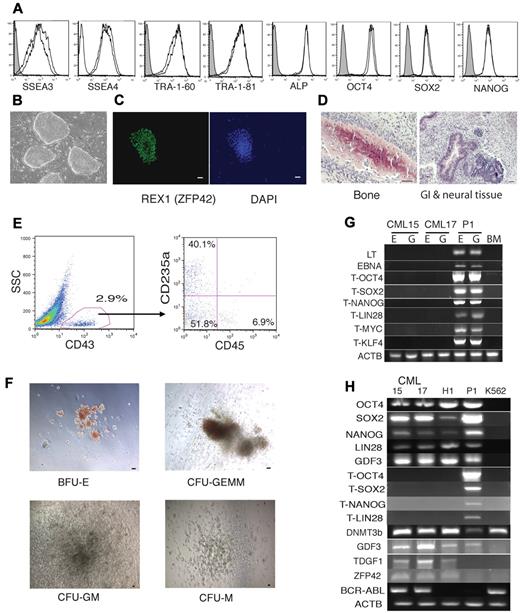 Figure 6. Generation of iPSCs from BM samples from a patient in the chronic phase of CML. (A) Flow cytometric analysis of hESC-specific marker expression in CML iPSC15 and CML iPSC17. (B) Bright-field image demonstrating typical hESC morphology of CML iPSCs growing on MEFs. (C) Representative immunofluorescent staining of CML iPSCs with REX1 antibody. Bar indicates 50 μm. (D) Representative H&E staining of teratoma generated from CMLiPS15 showing derivatives of 3 germ layers as indicated in each of the panels. (E) Flow cytometric demonstration of differentiation of CMLiPS15 into blood cells in OP9 coculture. (F) Colony-forming unit assay from blood progenitor cells differentiated from line CML iPSC15. BFU-E indicates burst-forming unit-erythroid; CFU-GEMM; colony-forming unit-granulocyte, erythrocyte, monocyte, and megakaryocyte; CFU-M, colony-forming unit-macrophage; CFU-GM, colony-forming unit-granulocyte and monocyte. (G) CML iPSC lines 15 and 17 are free of transgene and vector sequence; E indicates the episomal fraction and G the genomic fraction of DNA; BM, human BM genomic DNA; P1, human BM mononuclear cells transfected with identical constructs. The T series of primers are transgene specific. ACTB indicates human actin primers that were used to check the DNA quality. (H) CML iPSCs express pluripotent genes, but not the corresponding transgenes. P1 indicates human BM mononuclear cells transfected with identical constructs. The hESC line H1 is the positive control and the Philadelphia chromosome-positive line K562 is used as the negative control for pluripotency, but as a positive control for the BCR-ABL fusion gene.