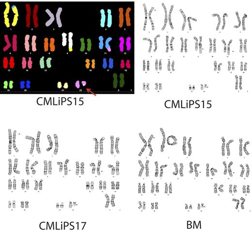 Figure 7. Karyograms of BM cells from a patient with CML and the 2 iPSCs derived from these cells. Top left panel shows spectral karyogram of CML iPSC15. SKY analysis demonstrates the 4-way translocation between chromosomes 1, 9, 11, and 22, shown here by classification-colored metaphase chromosomes. Translocations are apparent by the different colors of translocated segments representing the chromosome of origin. The Philadelphia chromosome is indicated by the red arrow. Standard G-banded karyotyping (top right and bottom panels) shows the complex 4-way translocation t(1;9;22;11)(p34.1;q34;q11.2;q23) found in all cells examined from the BM and from both iPSC lines (CML iPSC). The translocation 9;22 breakpoints of the BCR/ABL fusion are embedded in this rearrangement.