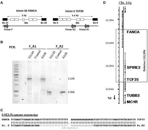Figure 4. PCR amplification of a fragment containing the breakpoint of ex1-20del. (A) Position of primers used, exons (black boxes), and Alu sequences (white boxes) found in regions flanking both breakpoints. (B) Fragments amplified by PCR in 2 patient carriers of the deletion (FA145 and FA58) and a control (not carrying this deletion) using 2 sets of primers. (C) Sequence of the 0.9-kb fragment containing the breakpoint (only relevant parts are shown). Sequence (bottom line) is aligned with FANCA and TCF25 (top line). (D) Scheme of the region affected by the deletion in chromosome 16q and genes included.