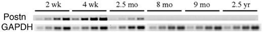 Figure 1. Semiquantitative RT-PCR of expressed Postn in BM from young and adult rabbits. Aliquots were removed 4 times at 2-cycle intervals during the PCR and analyzed by PAGE. Age of rabbits was from 2 weeks to 2.5 years. Postn indicates periostin; Gapdh was used as a control. Results are representative of 2 experiments.