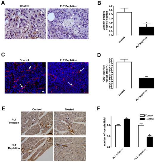 Figure 3. Blood vessel density is diminished on platelet depletion. (A-D) Subcutaneous B16-F10 tumors were implanted in mice undergoing platelet (PLT) depletion or injected with control rat IgG. After 9 days of growth, tumors were excised and sectioned. (A-B) Tumor sections were stained for laminin to visualize blood vessels. Laminin-positive vessels were quantified and represented as mean vessel number per section ± SEM (n = 6). (C-D) Frozen tumor sections were stained for CD31+ vessels (red) and 4,6-diamidino-2-phenylindole (blue). CD31+ blood vessels were quantified and represented as mean percentage of area ± SEM (n = 24). Arrows indicate vessels within the tissues. (E-F) Platelets were depleted or infused in mice directly after hindlimb ischemia surgery. Muscles from mice injected with PBS (PLT Infusion, Control) or 3 × 109 platelets (PLT Infusion, Treated) or rat IgG (PLT Depletion, Control) or rat antimouse GPIbα (PLT Depletion, Treated) were sectioned 14 days after surgery and immunostained for von Willebrand factor-positive blood vessels. Vessels were quantified and represented as mean vessel number per field ± SEM (n = 5). Scale bars represent 50 μm. *P < .05 vs control (Student t test). ***P < .005 vs control (Student t test).